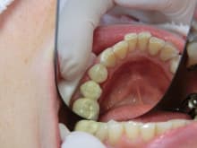 南館歯科クリニックのブログ