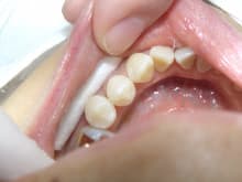 南館歯科クリニックのブログ